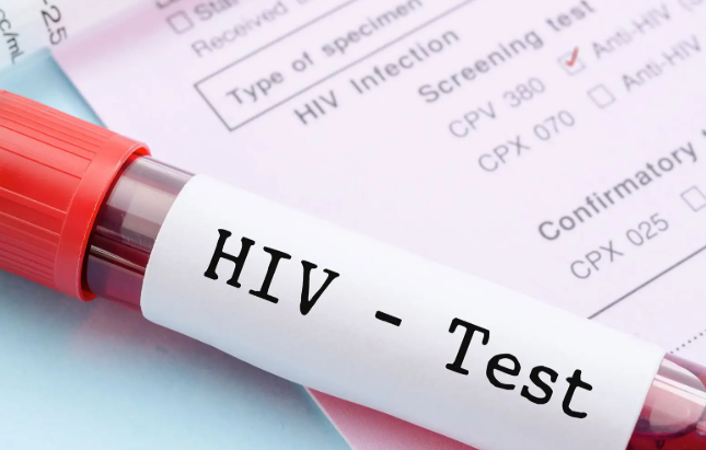 When it comes to personal health, HIV testing demands both discretion and accurate results. Because education and information have become