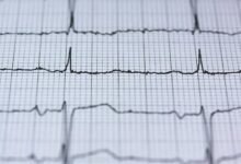 apex pulse opportunity engine